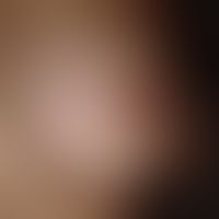 TS_Berlinxx 3